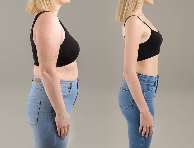 ozempic weight loss before and after pictures