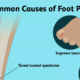 Pain in Various Foot Regions: Causes and Treatments