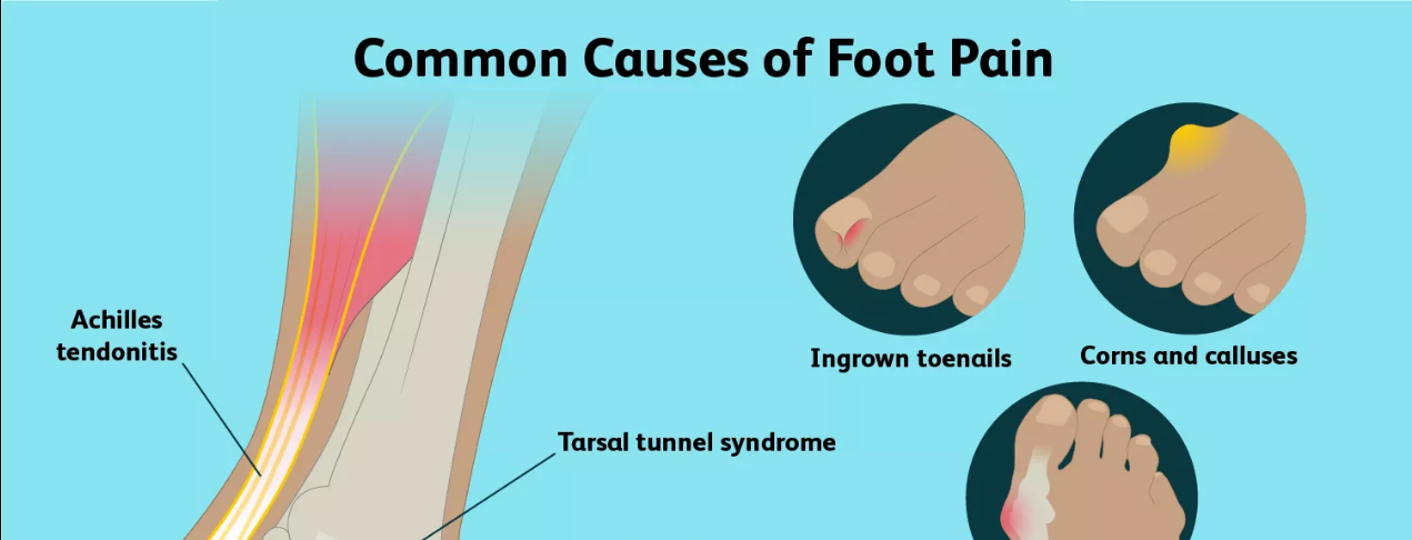 Pain in Various Foot Regions: Causes and Treatments